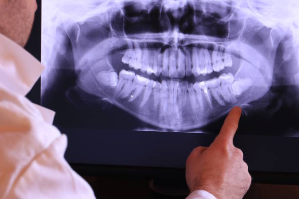 Best Broken or Chipped Tooth Repair in Greenwood, SC