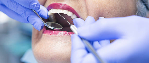 Best Emergency Care for Gum Disease in Greenwood, SC